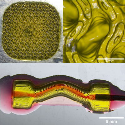 Bioprinting