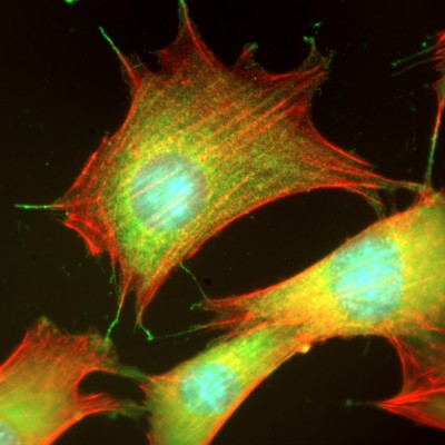 NIH3t3, DAPI, Fascin, Actin 