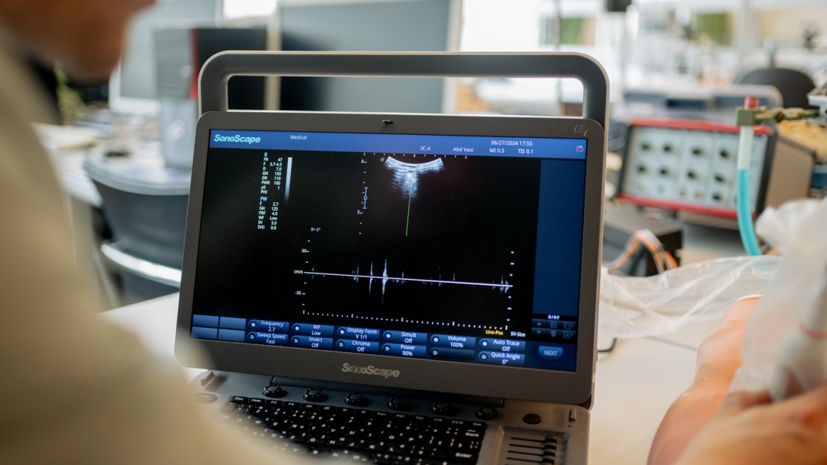 Ultraschall Computer
